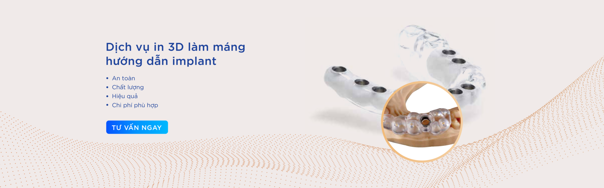 Máng Hướng Dẫn Phẫu Thuật
