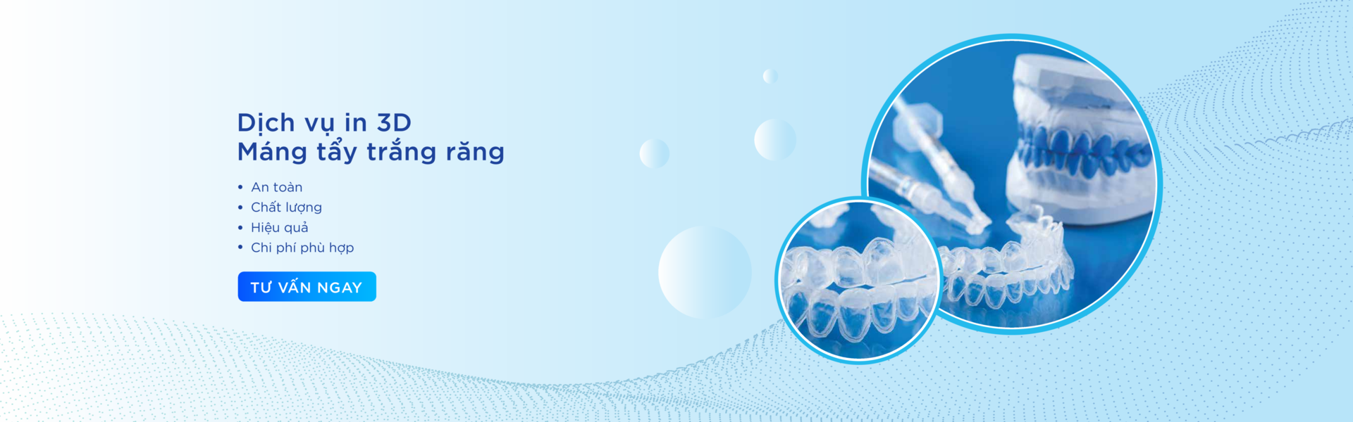 Máng tẩy trắng răng
