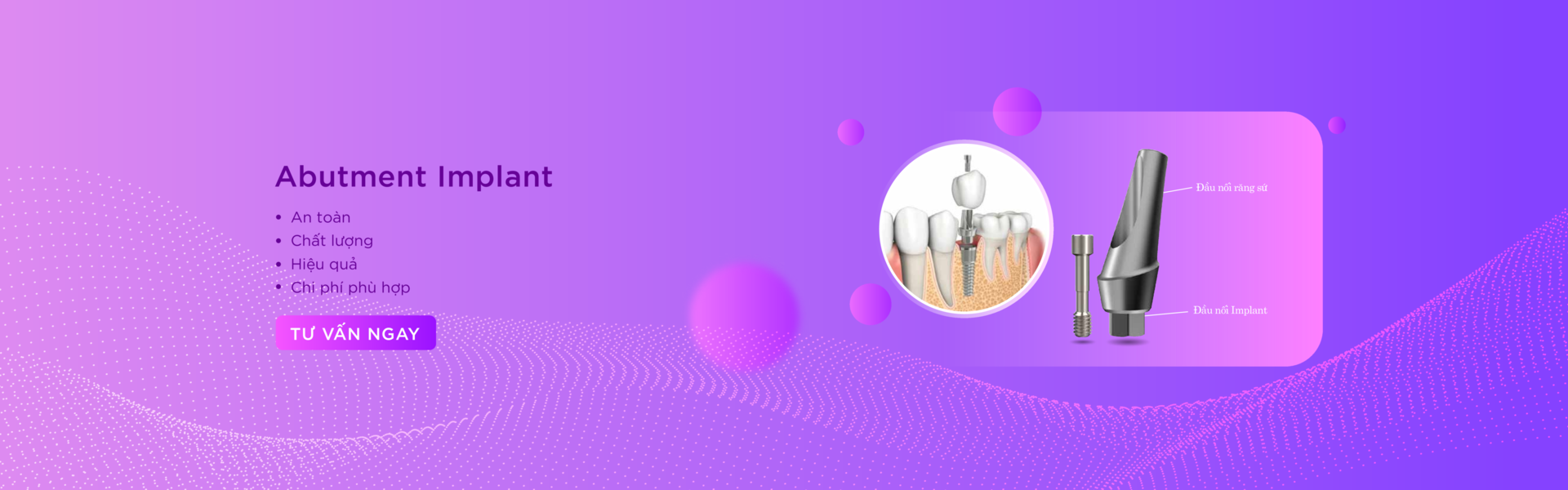 Abutment