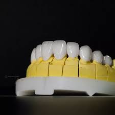 Răng sứ HT smile